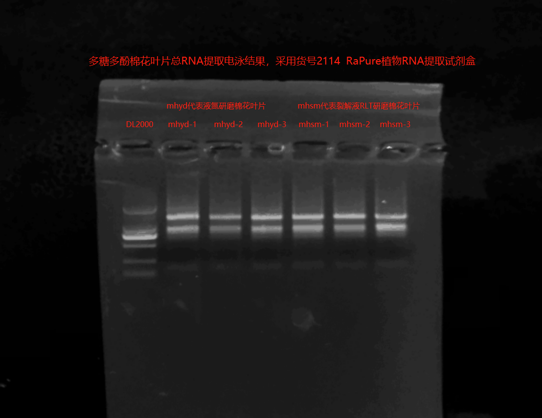 棉花葉片RNA提取電泳圖